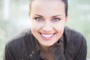 get FREE teeth whitening in Meridian today!