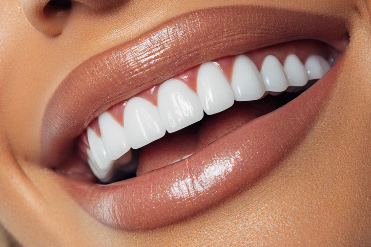 How to Choose the Best Cosmetic Dentist for Your Smile Makeover