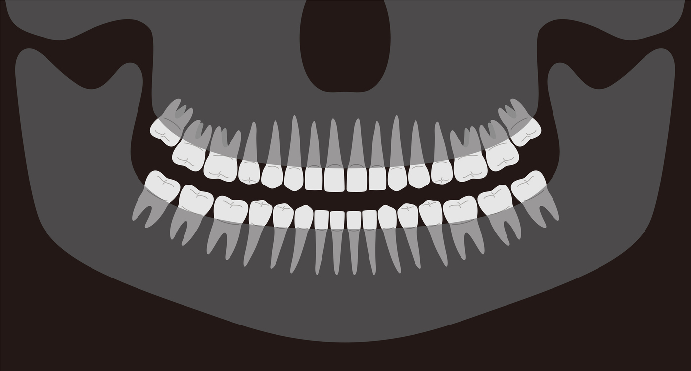 human X-ray picture of teeth, vector illustration