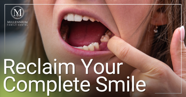 Reclaim Your Complete Smile Female showing missing tooth