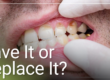 doctor looking at patients teeth