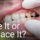 doctor looking at patients teeth