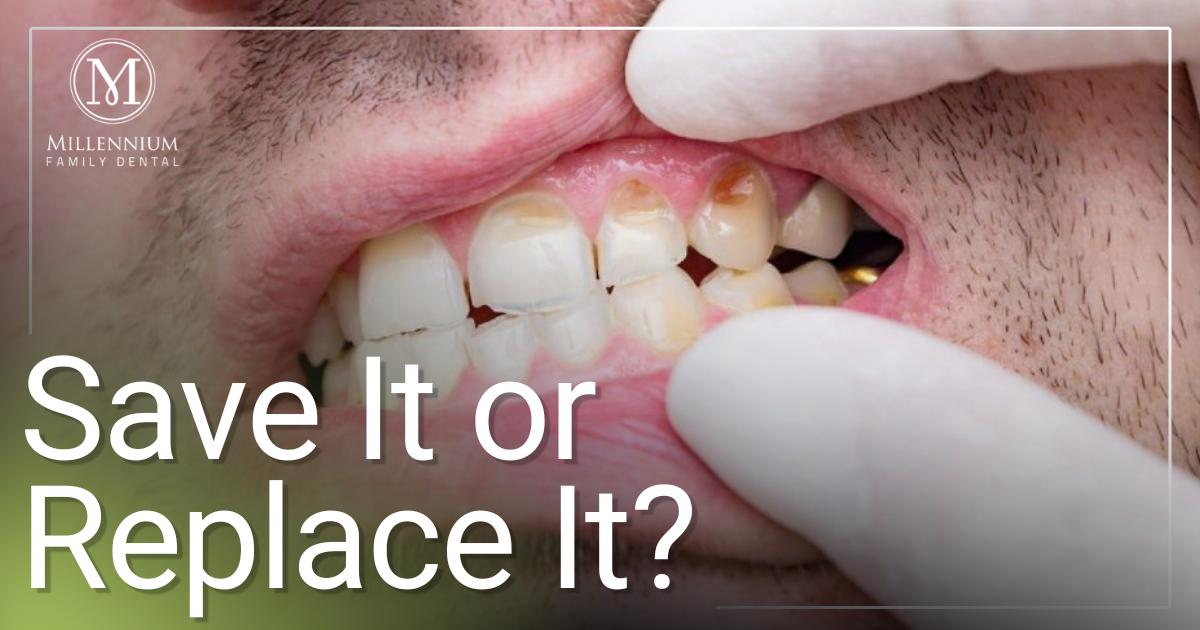 Save It or Replace It? doctor looking at patients teeth