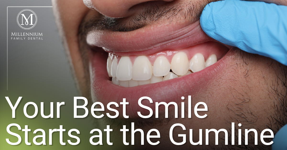 Your Best Smile Starts at the Gumline man smiling
